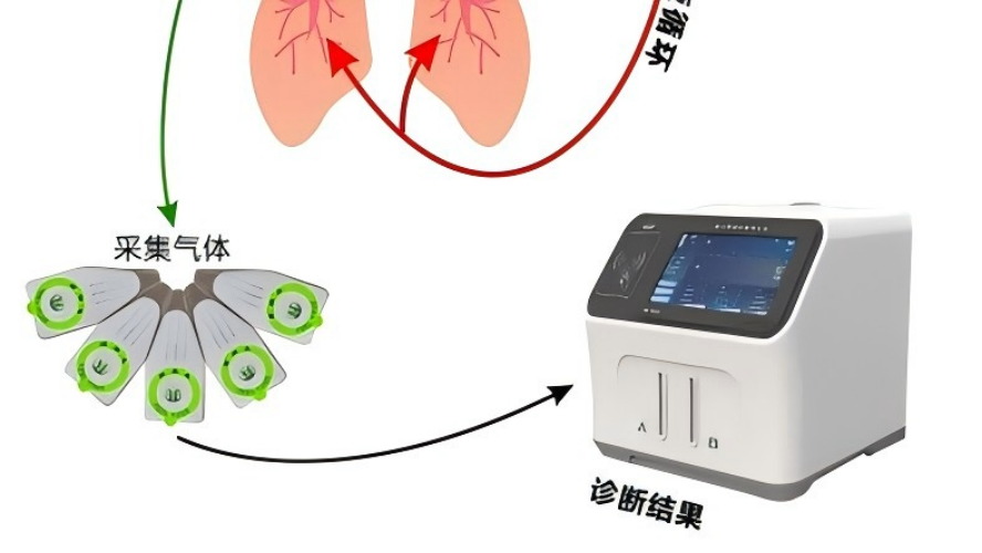 碳14呼气检测